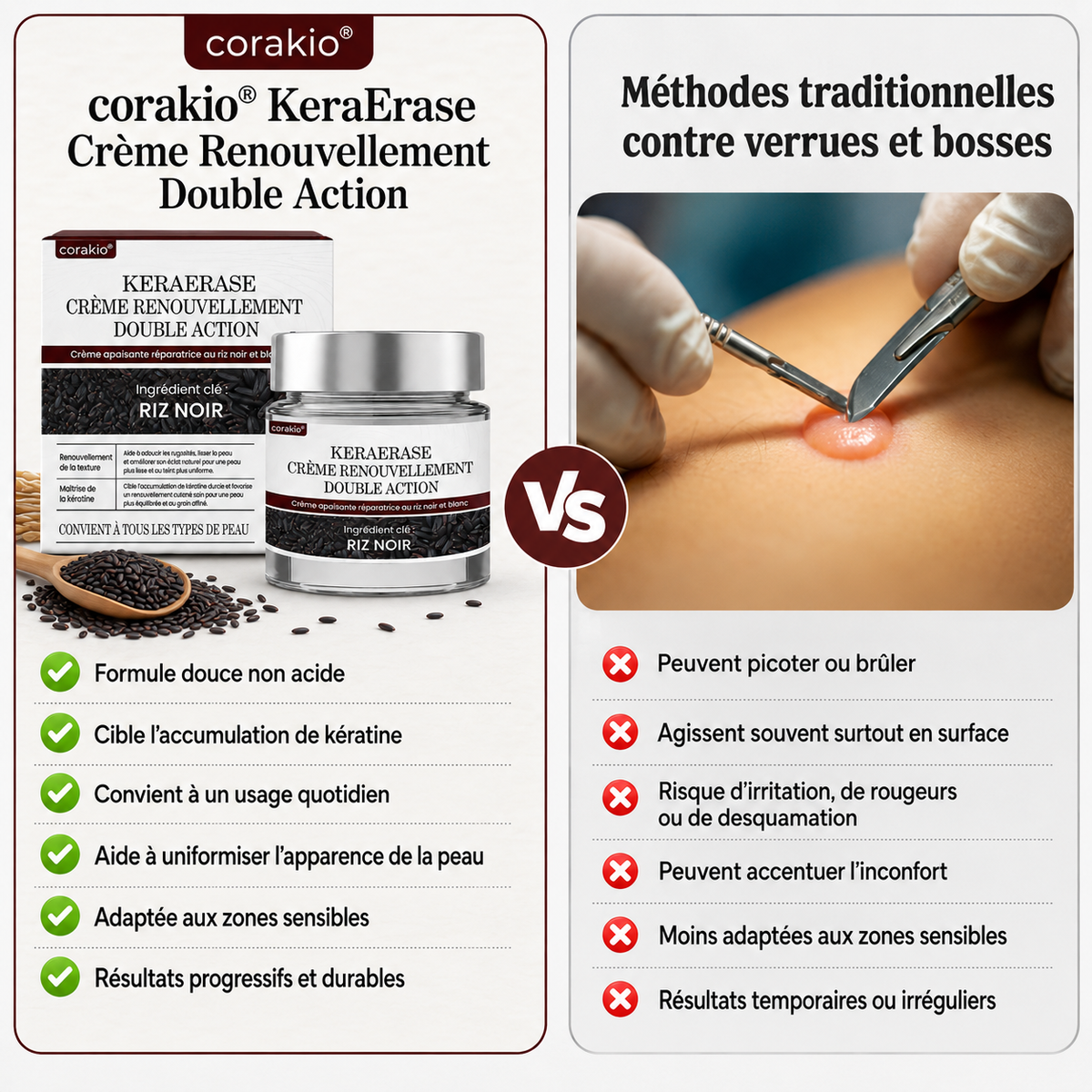 ✨Corakio® KeraErase Crème Rénovatrice Double Action