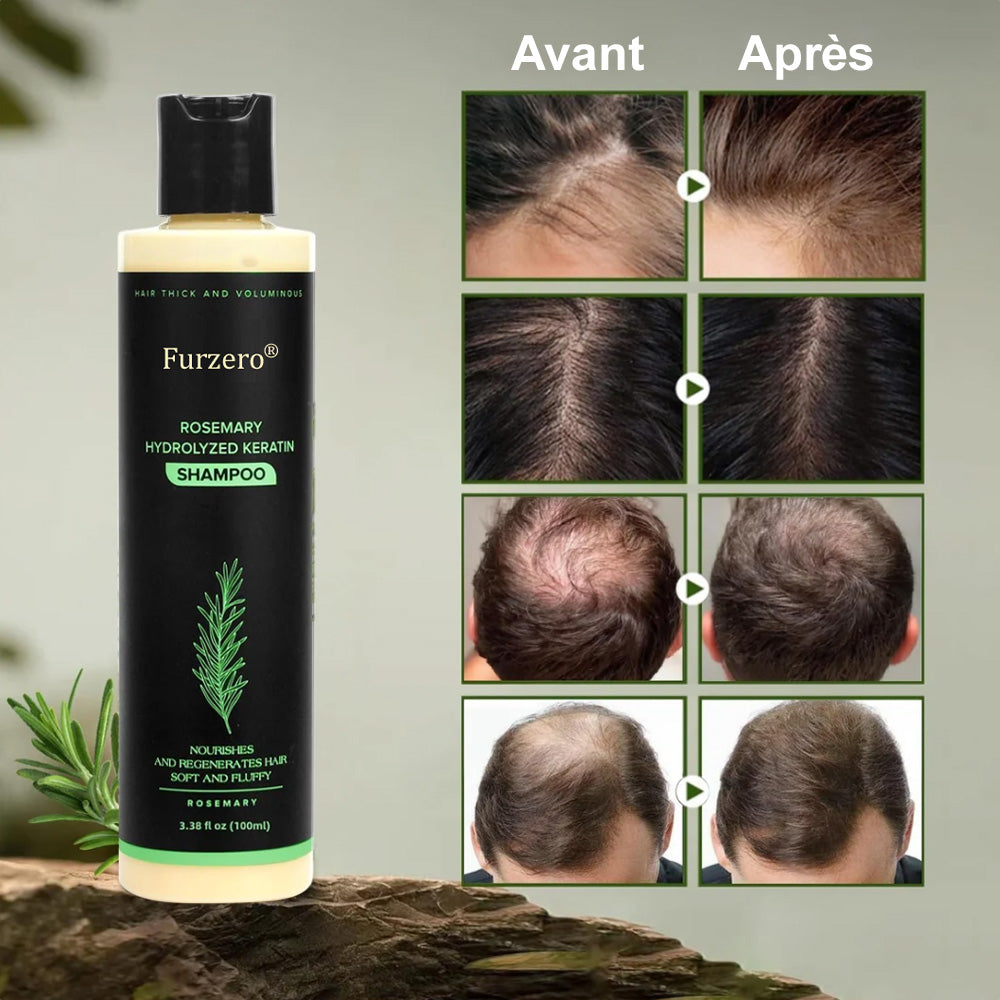 🔥DERNIÈRE CHANCE : -50% sur votre Shampooing Furzero® au Romarin ! 🌿