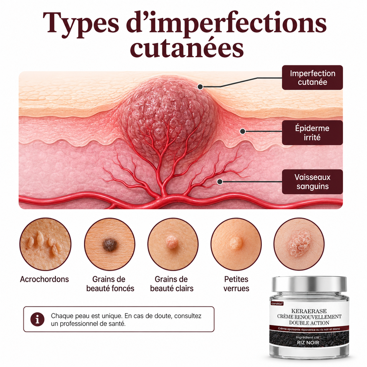 Corakio® KeraErase Crème Rénovatrice Double Action