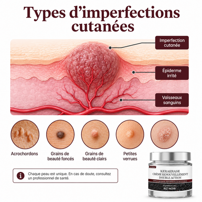 Corakio® KeraErase Crème Rénovatrice Double Action