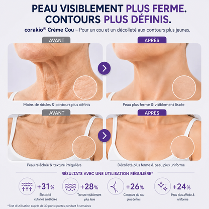 ⏳corakio® Crème Liftante Cou & Décolleté Roll-On