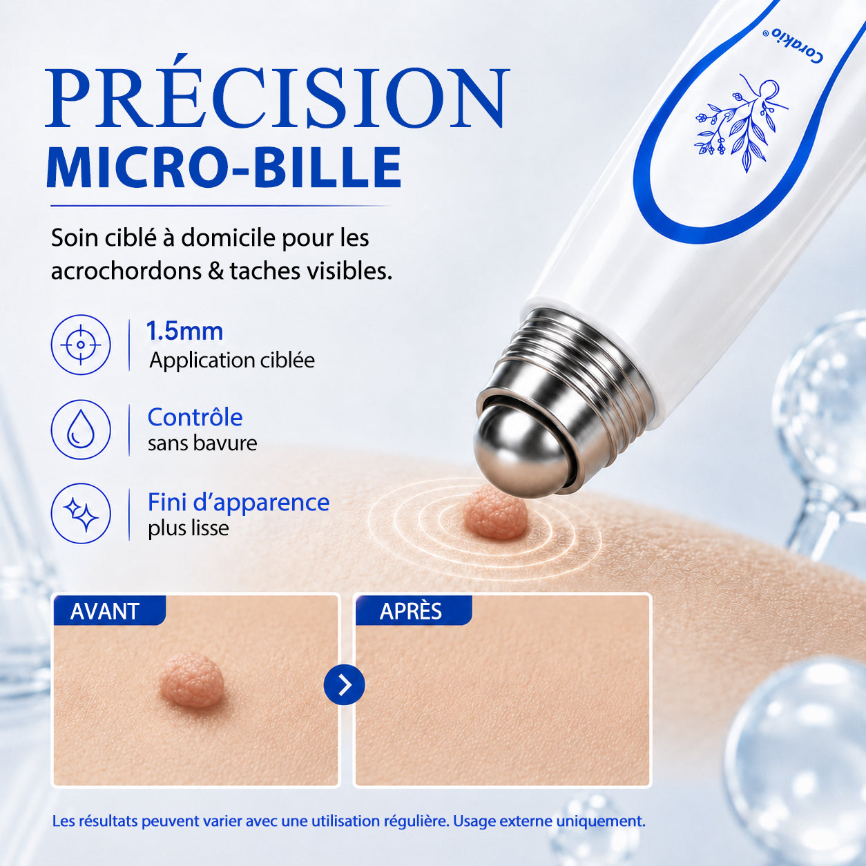 𝟕-𝐃𝒂𝘆 𝐒𝗸𝐢𝐧 𝐓𝒂𝗴 & 𝐒𝐩𝙤𝐭 𝐄𝐫𝒂𝐬𝙚𝐫 Painless & Scar-Free Advanced Imperfection Removal Rollerball Pen