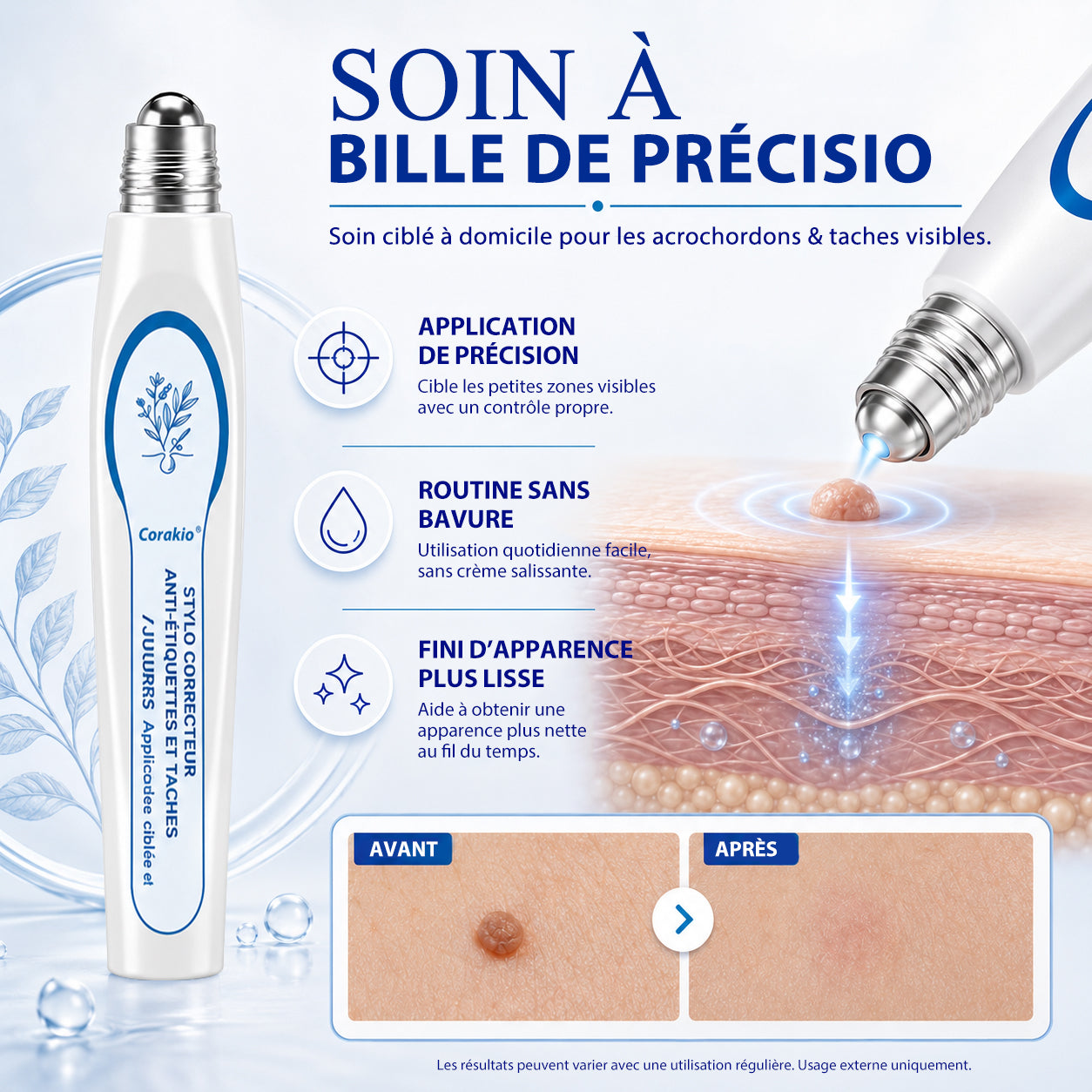 𝟕-𝐃𝒂𝘆 𝐒𝗸𝐢𝐧 𝐓𝒂𝗴 & 𝐒𝐩𝙤𝐭 𝐄𝐫𝒂𝐬𝙚𝐫 Painless & Scar-Free Advanced Imperfection Removal Rollerball Pen