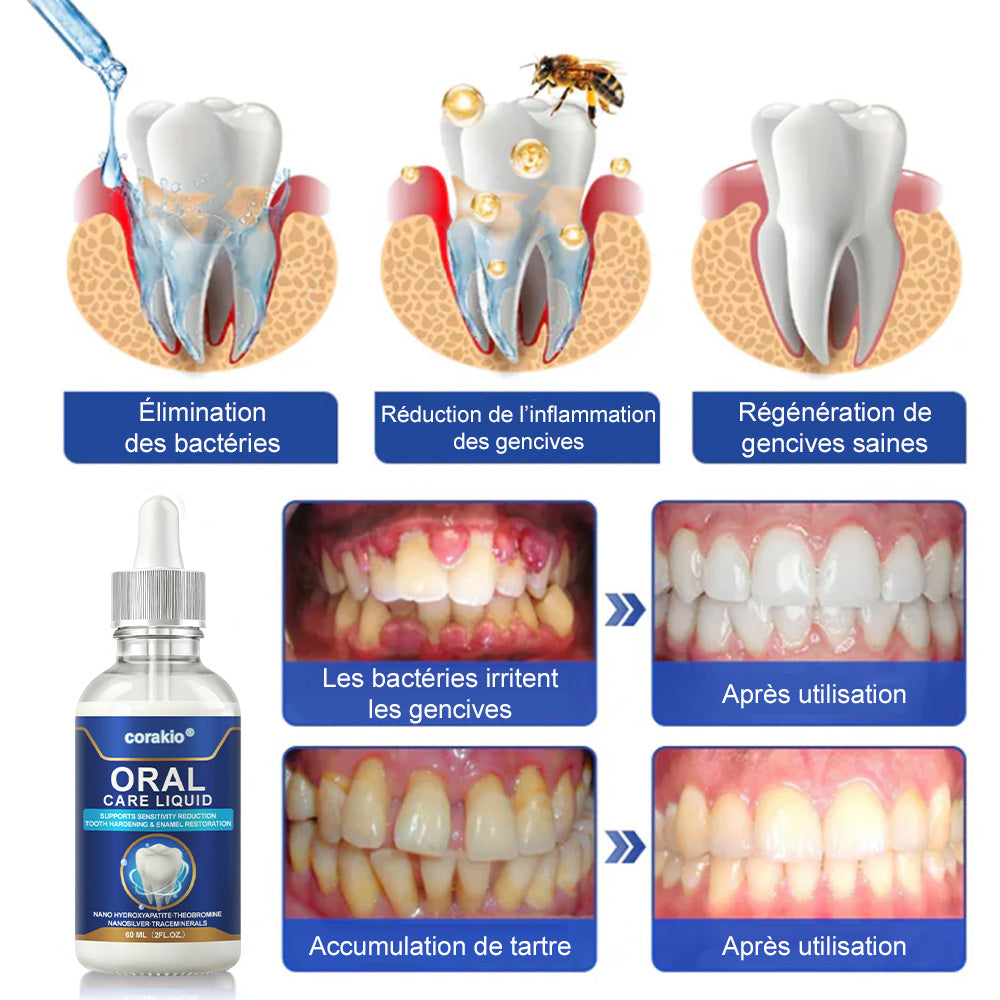 🦷🔥 Solution de Soins Buccaux – Traite efficacement les dommages à l'émail, l'inflammation gingivale, les maux de dents, la sensibilité dentaire, les saignements des gencives, la parodontite, les caries, les aphtes et la mauvaise haleine.