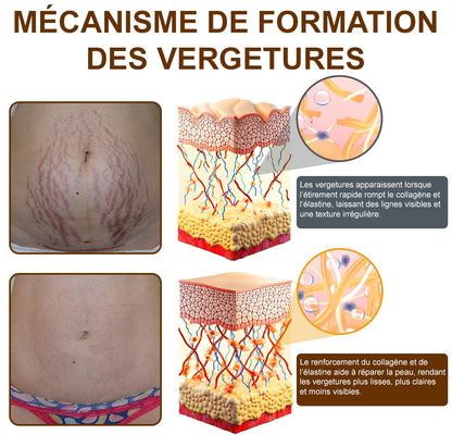 🪄Corakio® Silk Body Oil🍋 – Huile Raffermissante Corps Anti-Âge | Lisse, Lifte & Hydrate la Peau | Réduit les Rides & Restaure l’Élasticité Jeune