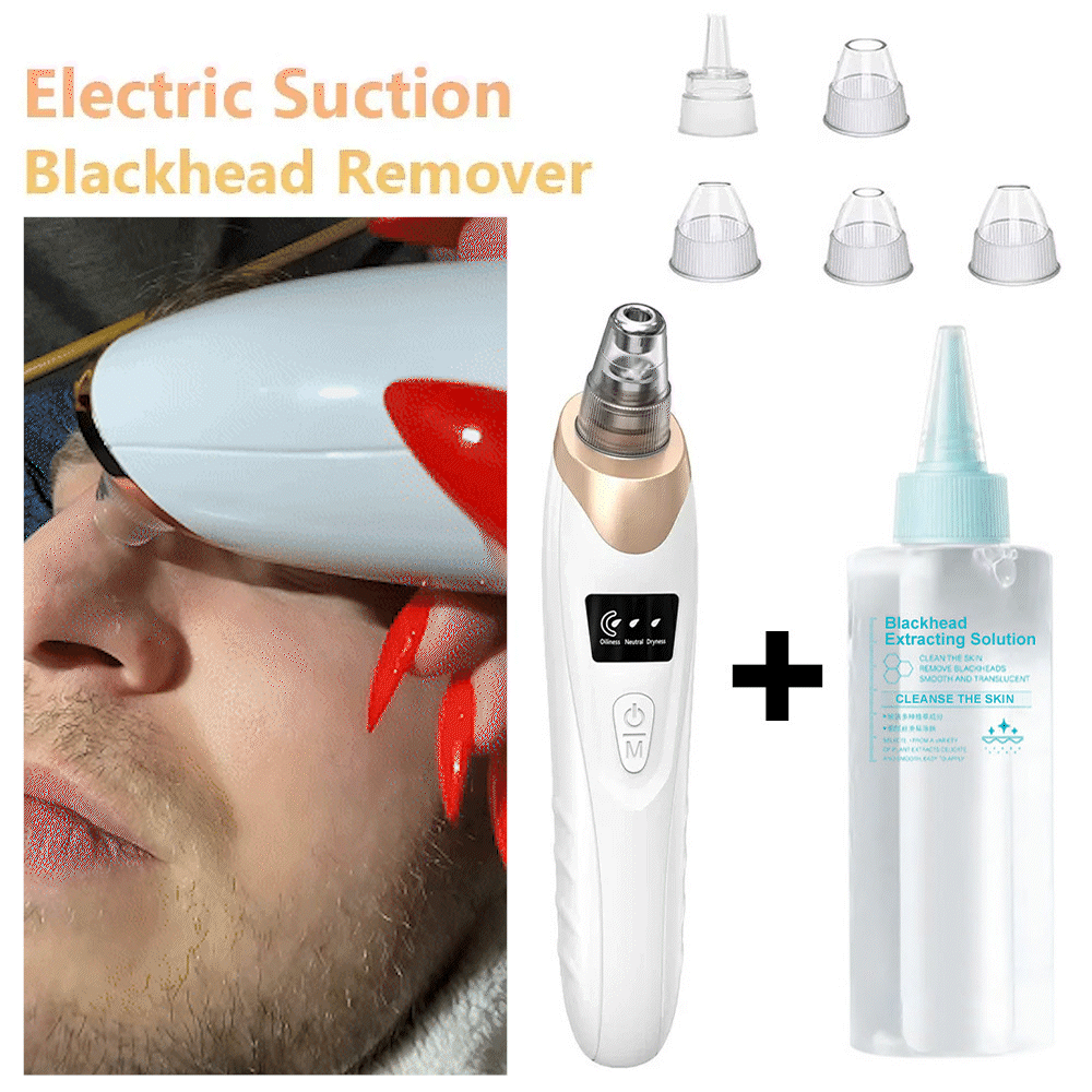 🆙Vide Pore électrique & Blackhead Remover - Rechargeable Spot Extractor Tool Setf