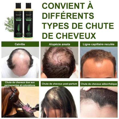 🔥DERNIÈRE CHANCE : -50% sur votre Shampooing Furzero® au Romarin ! 🌿