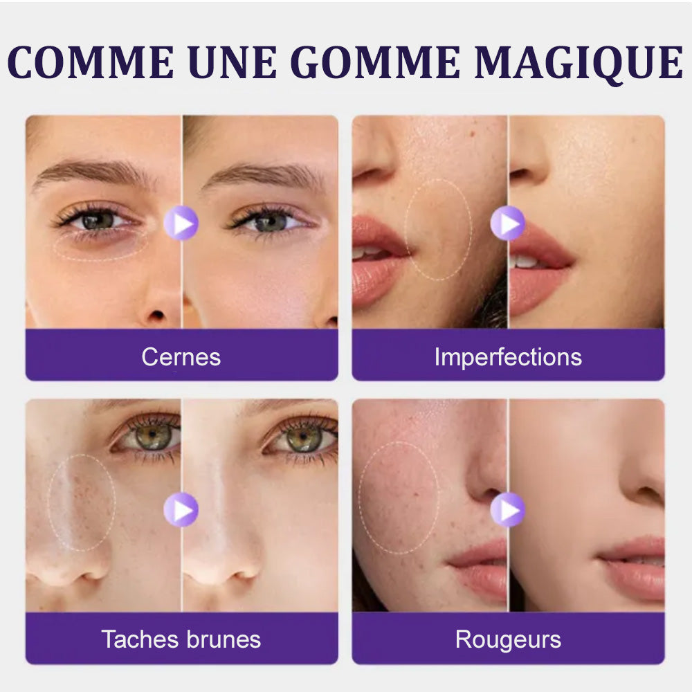👝corakio® Correcteur Mat Visage & Corps 24H – Waterproof, Sans Transfert, Haute Couvrance