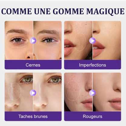 👝corakio® Correcteur Mat Visage & Corps 24H – Waterproof, Sans Transfert, Haute Couvrance