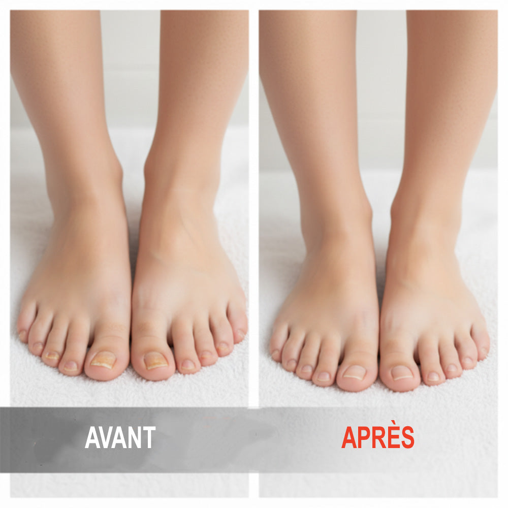 💕corakio® Essence Réparatrice pour Ongles Abîmés 💅🏻