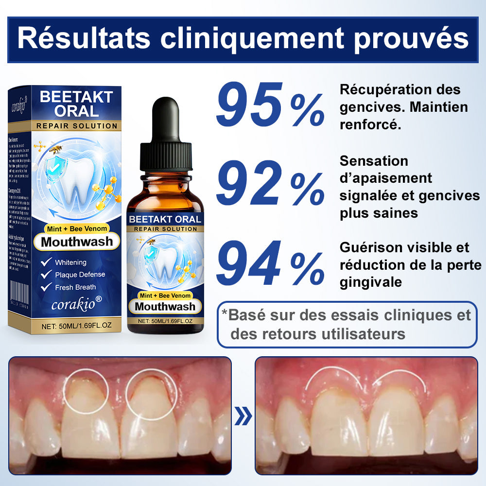 💡corakio® Soin Réparateur Buccal, Gouttes Concentrées au Venin d'Abeille contre le Déchaussement, Saignements & Plaque - Alternative au Bain de Bouche
