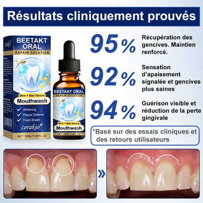 💡corakio® Soin Réparateur Buccal, Gouttes Concentrées au Venin d'Abeille contre le Déchaussement, Saignements & Plaque - Alternative au Bain de Bouche