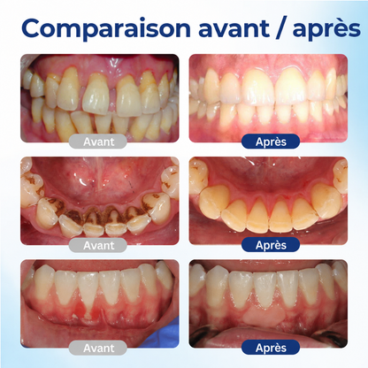 🦷 Corakio® Solution Bucco-Dentaire Réparatrice au Venin d’Abeille — Bain de Bouche Concentré pour Haleine Fraîche & Protection Anti-Plaque