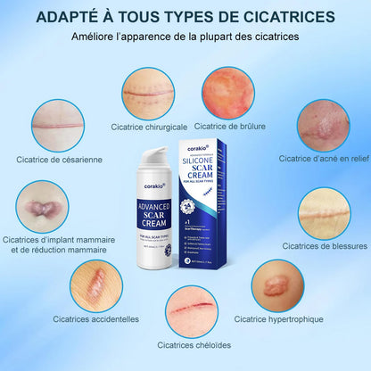 ✨corakio® Gel Avancé au Silicone pour Cicatrices – Crème Professionnelle Anti-Cicatrices pour Cicatrices Chirurgicales, Chéloïdes, Vergetures, Cicatrices de Césarienne & Réparation des Cicatrices Anciennes ou Récentes
