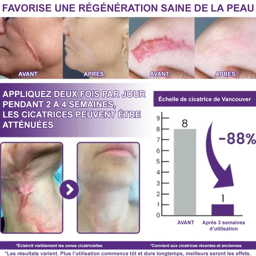 🌸Gel Réparateur Anti-Cicatrices – Amélioration Visible en 7 Jours