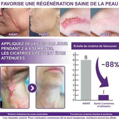 🌸Gel Réparateur Anti-Cicatrices – Amélioration Visible en 7 Jours