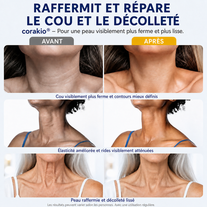 ⏳corakio® Crème Liftante Cou & Décolleté Roll-On