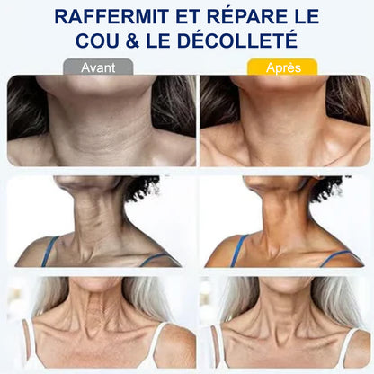 ✨corakio® Crème de massage pour le cou à rouleau ✨ Collagène & acide hyaluronique | Raffermit le cou, atténue l’apparence des rides et du double menton
