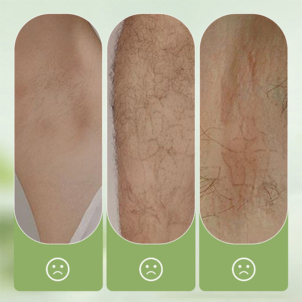 🧼Corakio® Crème Épilatoire Douce et Non Irritante
