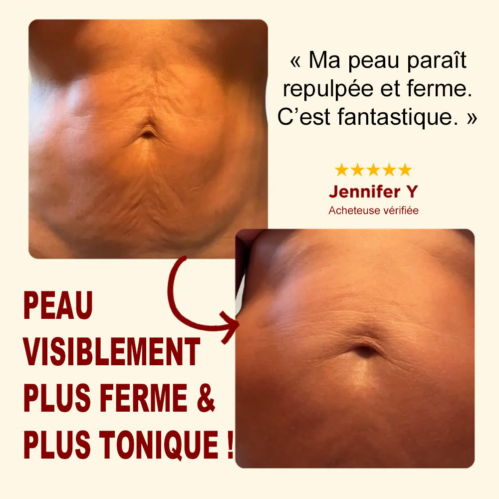 🪄Corakio® Silk Body Oil🍋 – Huile Raffermissante Corps Anti-Âge | Lisse, Lifte & Hydrate la Peau | Réduit les Rides & Restaure l’Élasticité Jeune