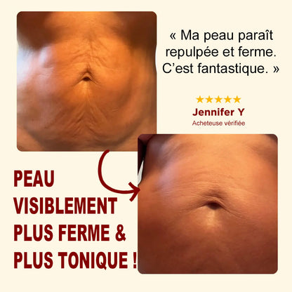 🪄Corakio® Silk Body Oil🍋 – Huile Raffermissante Corps Anti-Âge | Lisse, Lifte & Hydrate la Peau | Réduit les Rides & Restaure l’Élasticité Jeune