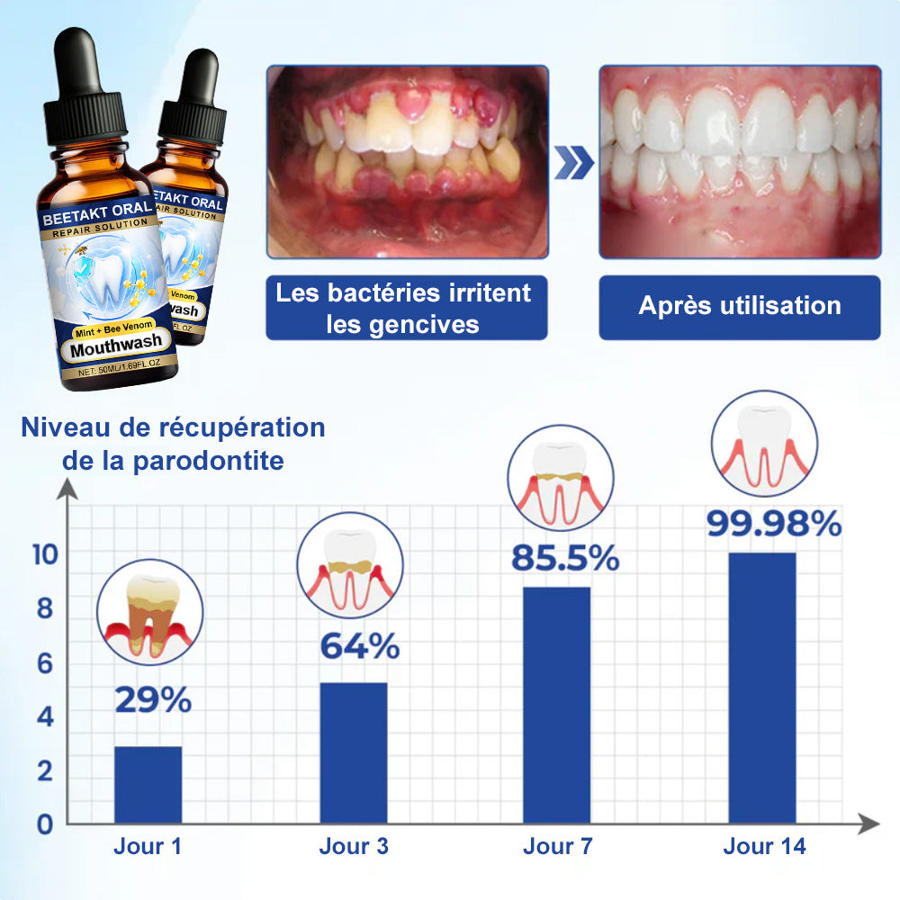 💡corakio® Soin Réparateur Buccal, Gouttes Concentrées au Venin d'Abeille contre le Déchaussement, Saignements & Plaque - Alternative au Bain de Bouche