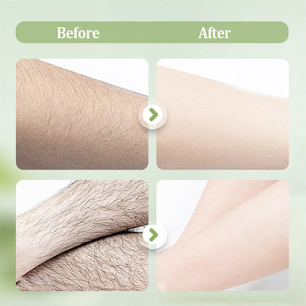 🧼Corakio® Crème Épilatoire Douce et Non Irritante