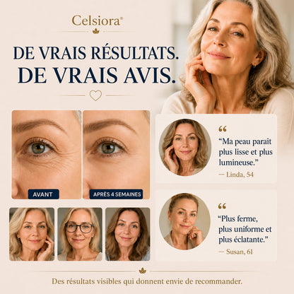 up Celsiora® Crème Visage Anti-Rides - PDRN + Multi-Peptides pour une peau visiblement plus lisse, plus ferme et plus lumineuse.