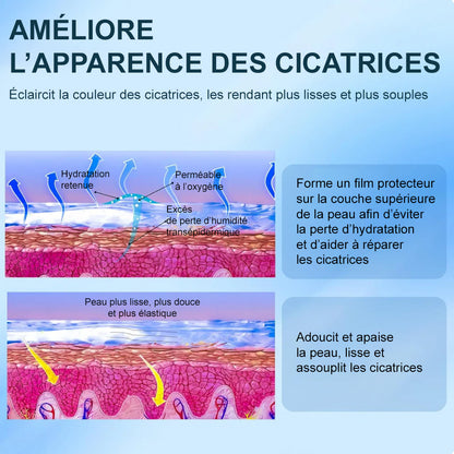 ✨corakio® Gel Avancé au Silicone pour Cicatrices – Crème Professionnelle Anti-Cicatrices pour Cicatrices Chirurgicales, Chéloïdes, Vergetures, Cicatrices de Césarienne & Réparation des Cicatrices Anciennes ou Récentes