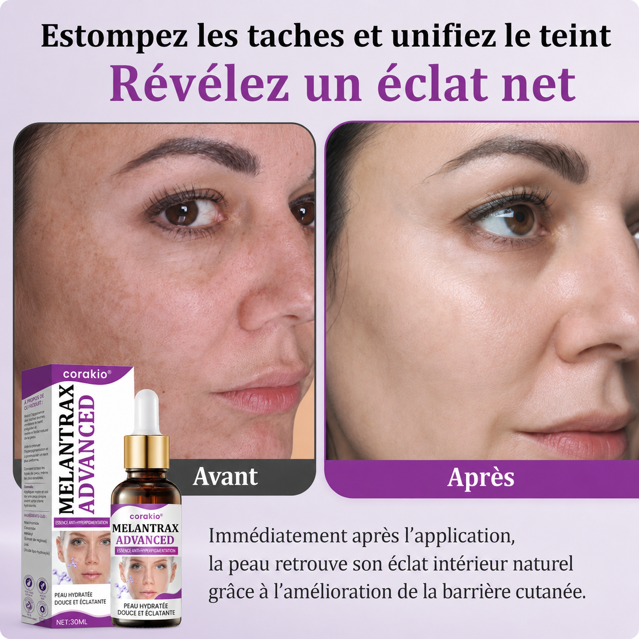 🆙corakio® MelantraX – Essence avancée anti-hyperpigmentation