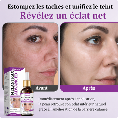 🆙corakio® MelantraX – Essence avancée anti-hyperpigmentation