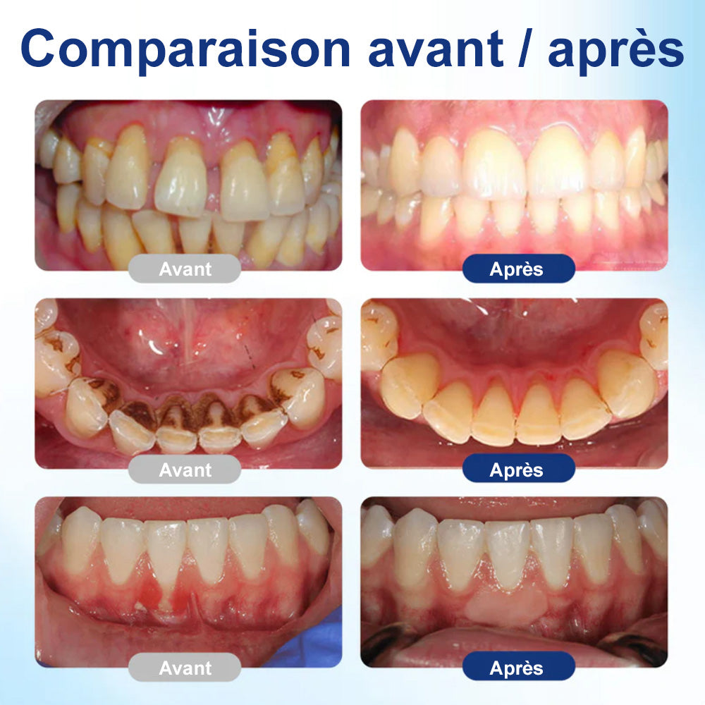 🦷 corakio® Sérum de Défense Dentaire NanoHAP