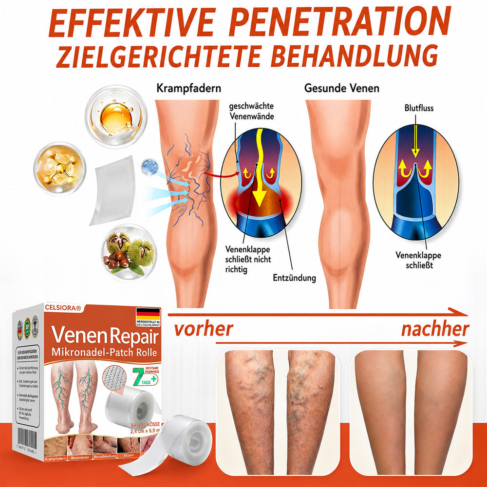 ✅ Celsiora® Vein Ease Microneedle-Pflegepflaster – Bei Besenreisern, Krampfadern, Schwellungen & müden Beinen | Nur heute 50 % Rabatt