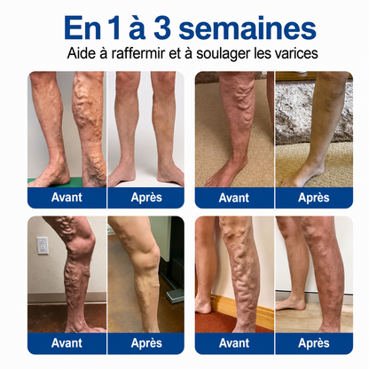 🧙 corakio® VeinTarget – Patch à micro-aiguilles ⚡ Soulagement instantané, résultats durables