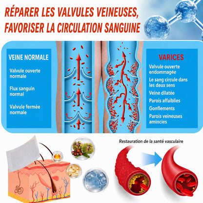✅ Patchs de soin à micro-aiguilles Celsiora® Vein Ease – Pour les varicosités, les varices, les gonflements et les jambes fatiguées | Aujourd’hui seulement : -50 %