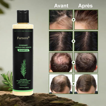 🔥DERNIÈRE CHANCE : -50% sur votre Shampooing Furzero® au Romarin ! 🌿