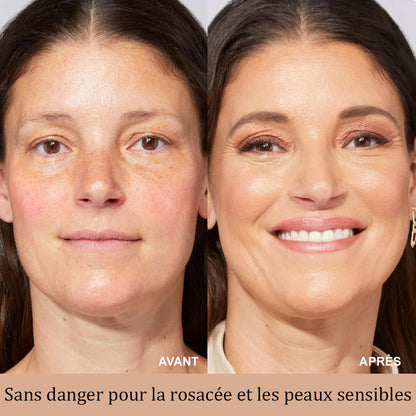 ☁️Corakio® BB Blur Crème Teintée SPF 30 – Illumine, Hydrate & Lisse Instantanément la Peau ✨