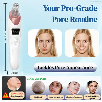🆙Vide Pore électrique & Blackhead Remover - Rechargeable Spot Extractor Tool Setf