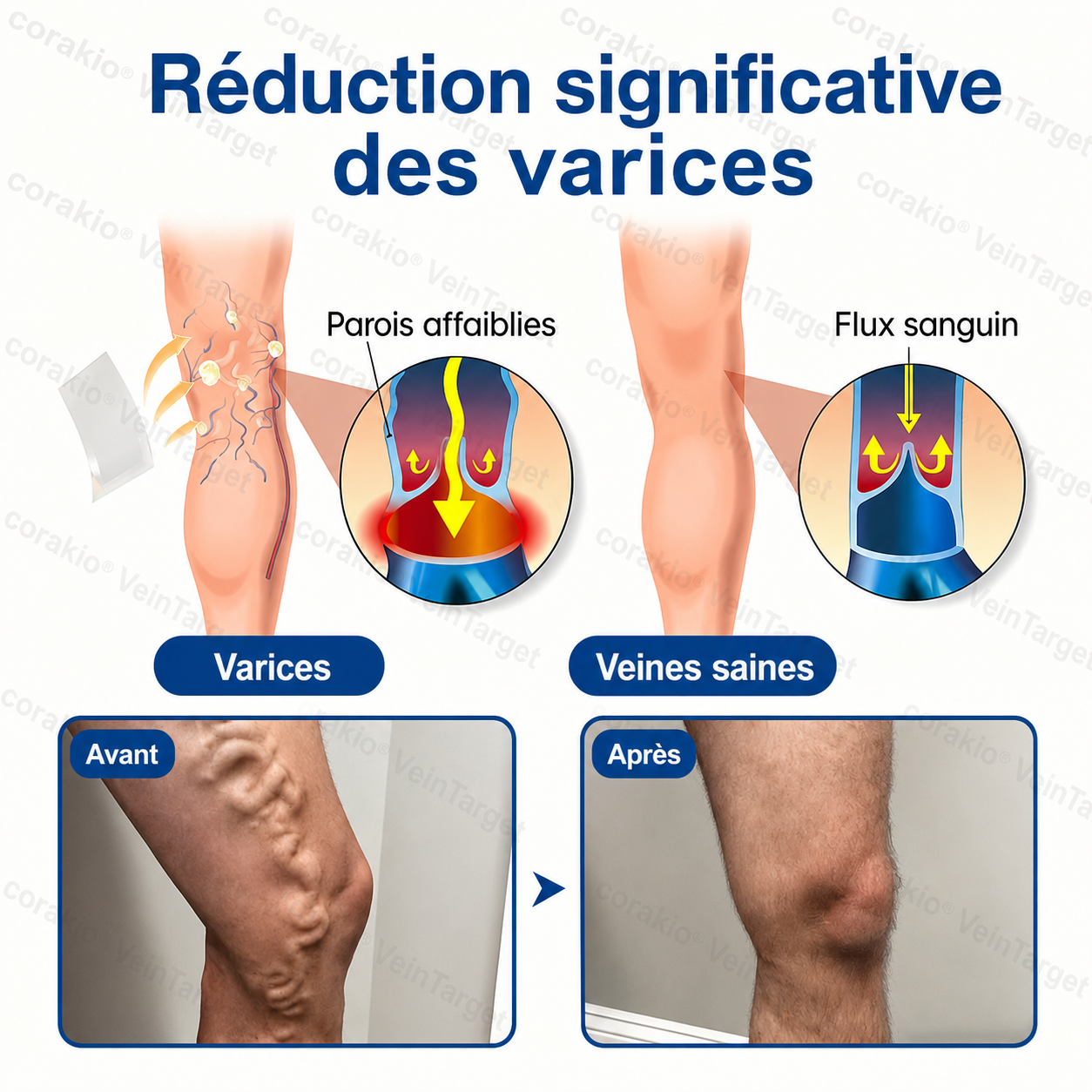 🧙 corakio® VeinTarget – Patch à micro-aiguilles ⚡ Soulagement instantané, résultats durables