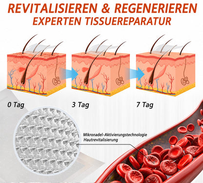 ✅ Celsiora® Vein Ease Microneedle-Pflegepflaster – Bei Besenreisern, Krampfadern, Schwellungen & müden Beinen | Nur heute 50 % Rabatt