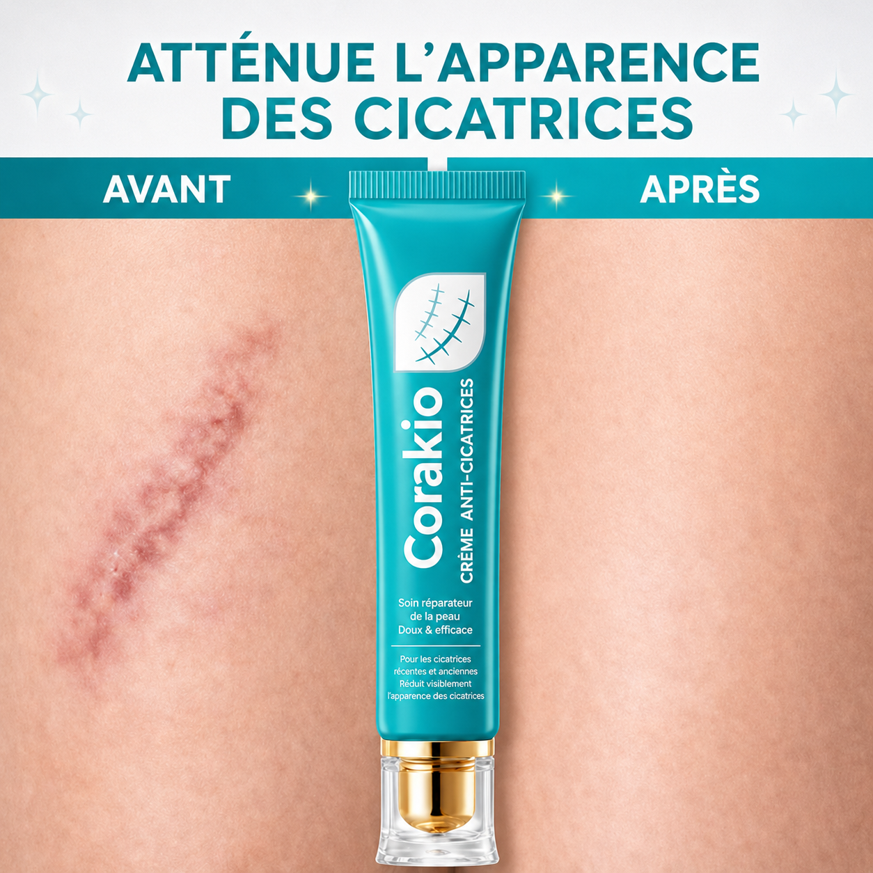 ✨ Corakio® Crème Réparatrice Anti-Cicatrices — Vergetures Cicatrices & Marques d’Acné