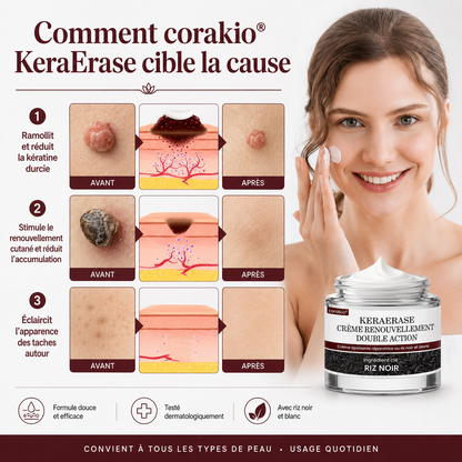 Corakio® KeraErase Crème Rénovatrice Double Action