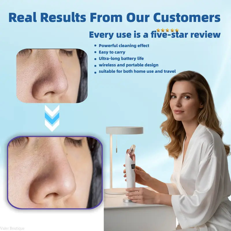 🆙Vide Pore électrique & Blackhead Remover - Rechargeable Spot Extractor Tool Setf