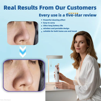 🆙Vide Pore électrique & Blackhead Remover - Rechargeable Spot Extractor Tool Setf