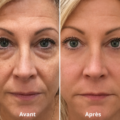 🌸Corakio® Crème Raffermissante Anti-Âge aux Polypeptides