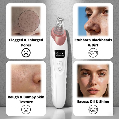 🆙Vide Pore électrique & Blackhead Remover - Rechargeable Spot Extractor Tool Setf