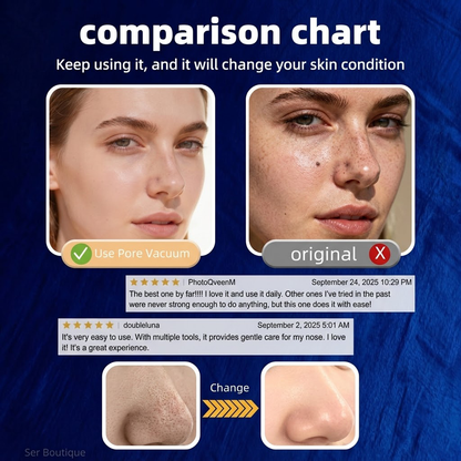 🆙Vide Pore électrique & Blackhead Remover - Rechargeable Spot Extractor Tool Setf